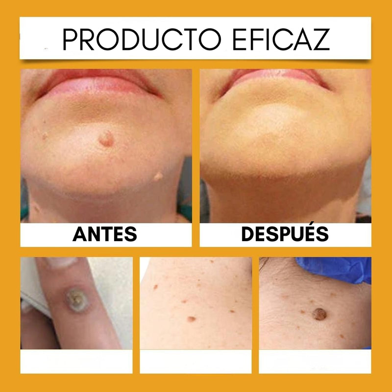 🐝 Tag Recede Spray Premium – El poder natural del Veneno de Abeja