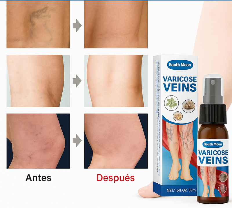Lleve 2 y pague 1  🍃 Spray Varicose Veins  - Alivio natural para venas y varices ✨